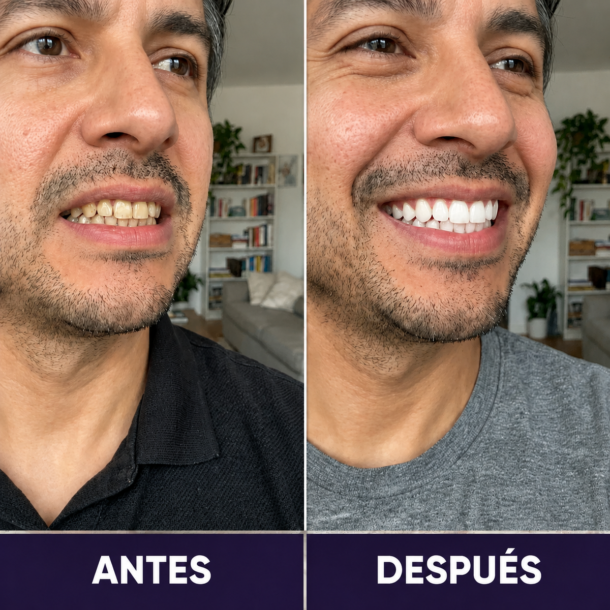 (2x1) Blanqueador Dental YASENSHI | Sonrisa de Revista en 3 minutos