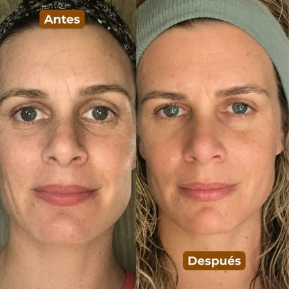Rostro más definido, firme y deshinchado en 5 minutos